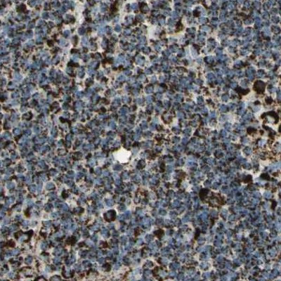 ME2 Antibody in Immunohistochemistry (IHC)