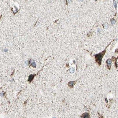 ME2 Antibody in Immunohistochemistry (IHC)