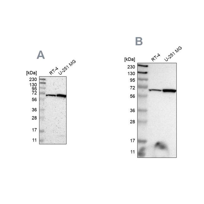 ME2 Antibody in Western Blot (WB)