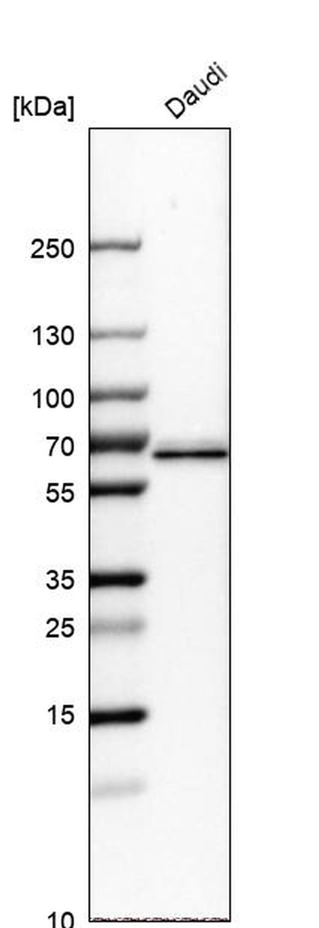 ME2 Antibody in Western Blot (WB)