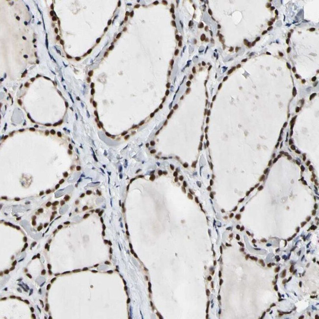 NFIA Antibody in Immunohistochemistry (IHC)