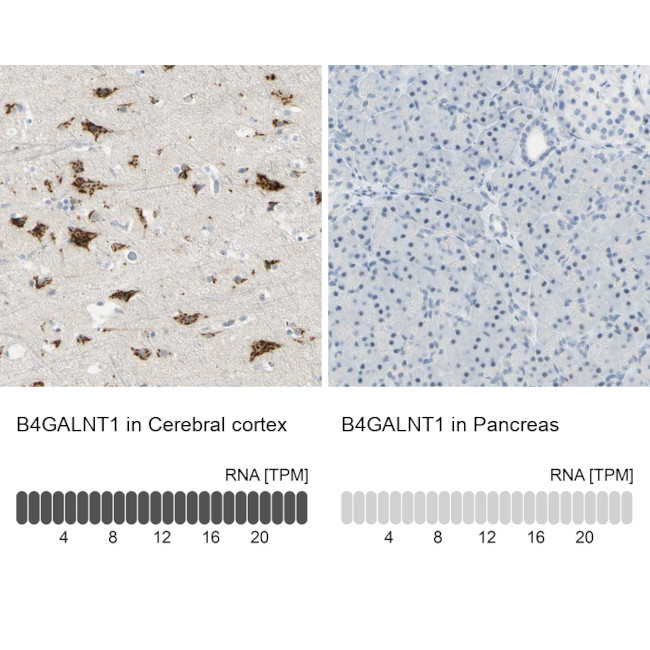 B4GALNT1 Antibody in Immunohistochemistry (IHC)