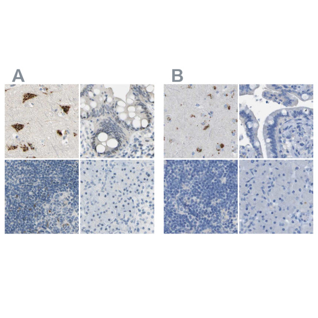 B4GALNT1 Antibody in Immunohistochemistry (IHC)