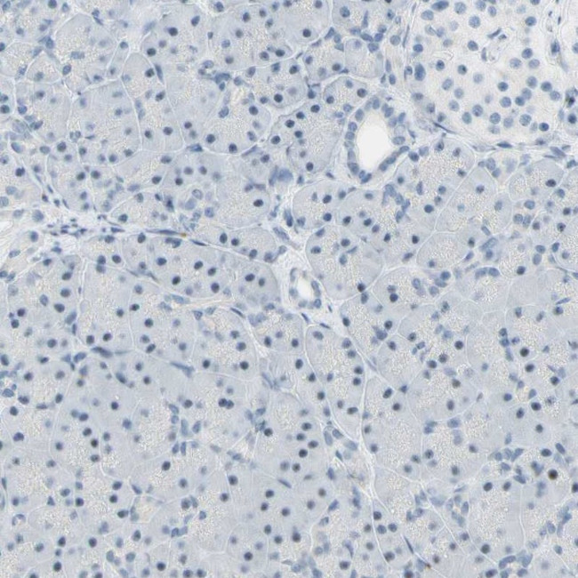 B4GALNT1 Antibody in Immunohistochemistry (IHC)