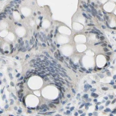 B4GALNT1 Antibody in Immunohistochemistry (IHC)