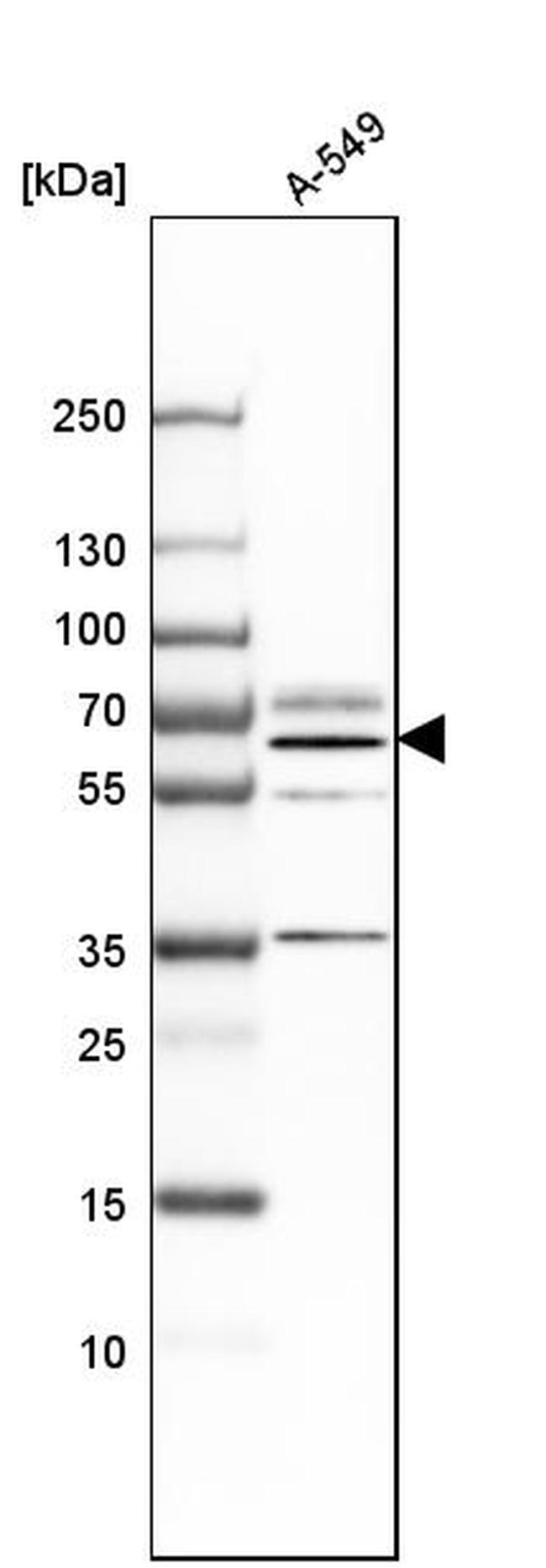 B4GALNT1 Antibody in Western Blot (WB)