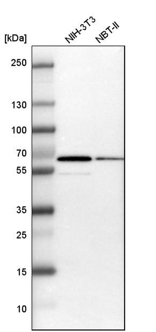 B4GALNT1 Antibody in Western Blot (WB)