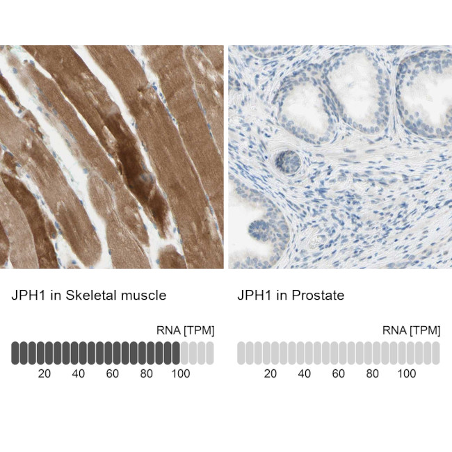 JPH1 Antibody in Immunohistochemistry (IHC)