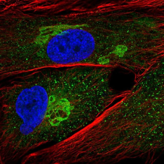 GALNT5 Antibody in Immunocytochemistry (ICC/IF)