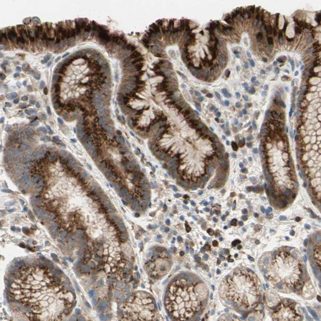 GALNT5 Antibody in Immunohistochemistry (IHC)