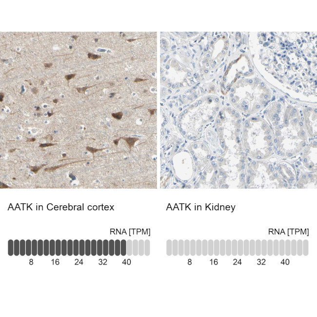AATK Antibody in Immunohistochemistry (IHC)