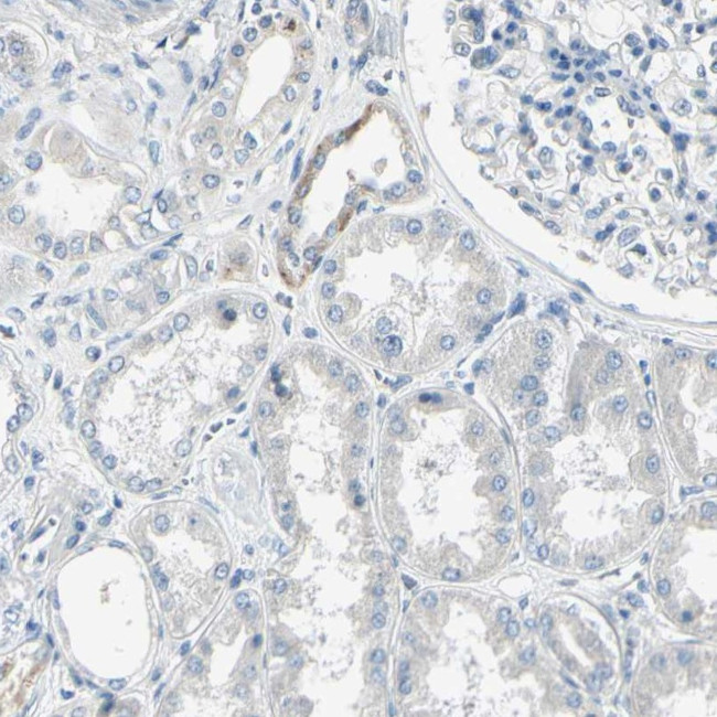 AATK Antibody in Immunohistochemistry (IHC)