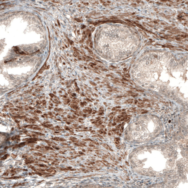 COL12A1 Antibody in Immunohistochemistry (IHC)