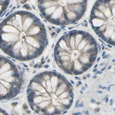 LHPP Antibody in Immunohistochemistry (IHC)