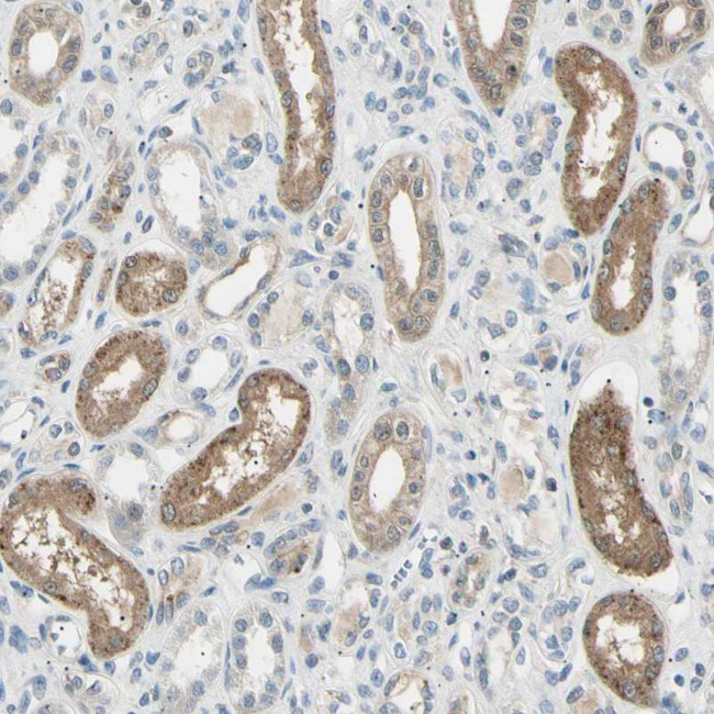 LHPP Antibody in Immunohistochemistry (IHC)