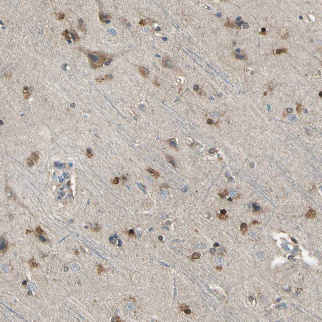 LHPP Antibody in Immunohistochemistry (IHC)