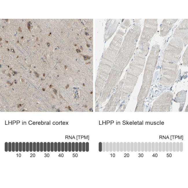 LHPP Antibody