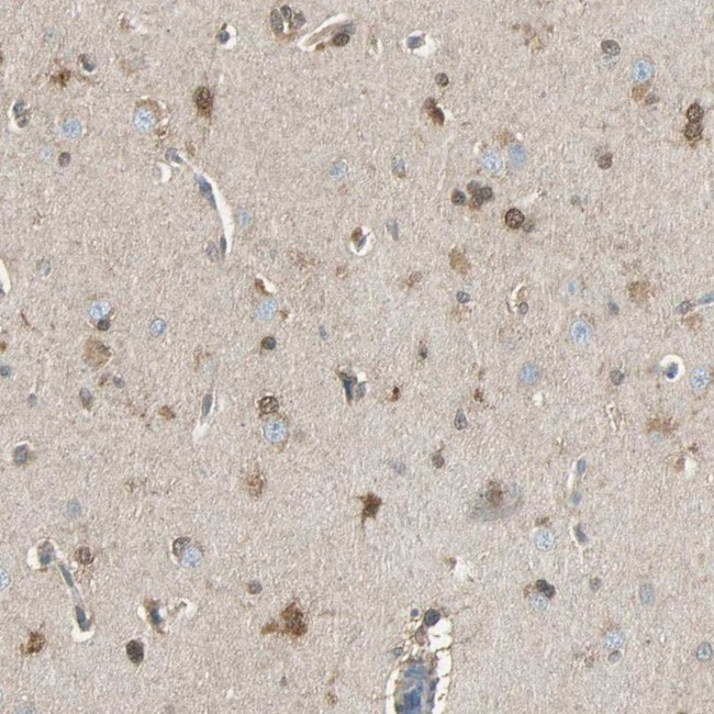 LHPP Antibody in Immunohistochemistry (IHC)