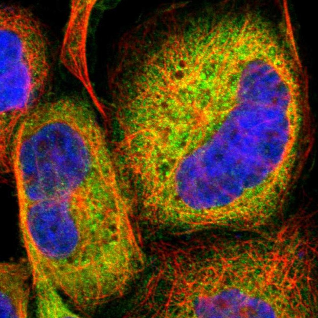 Laminin alpha-3 Antibody in Immunocytochemistry (ICC/IF)