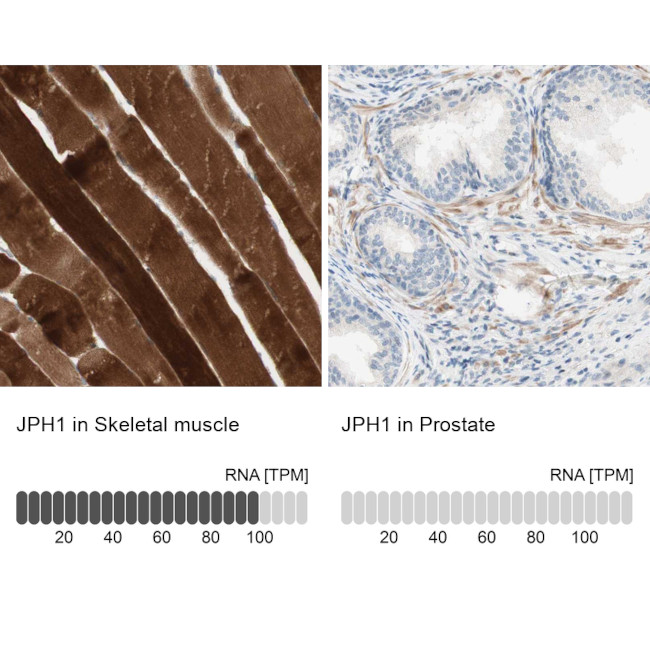 JPH1 Antibody in Immunohistochemistry (IHC)