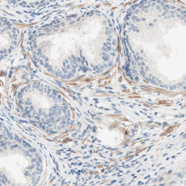 JPH1 Antibody in Immunohistochemistry (IHC)