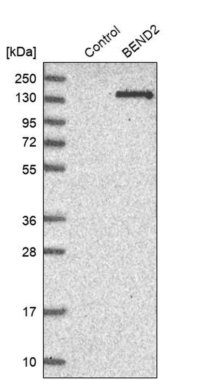 BEND2 Antibody in Western Blot (WB)