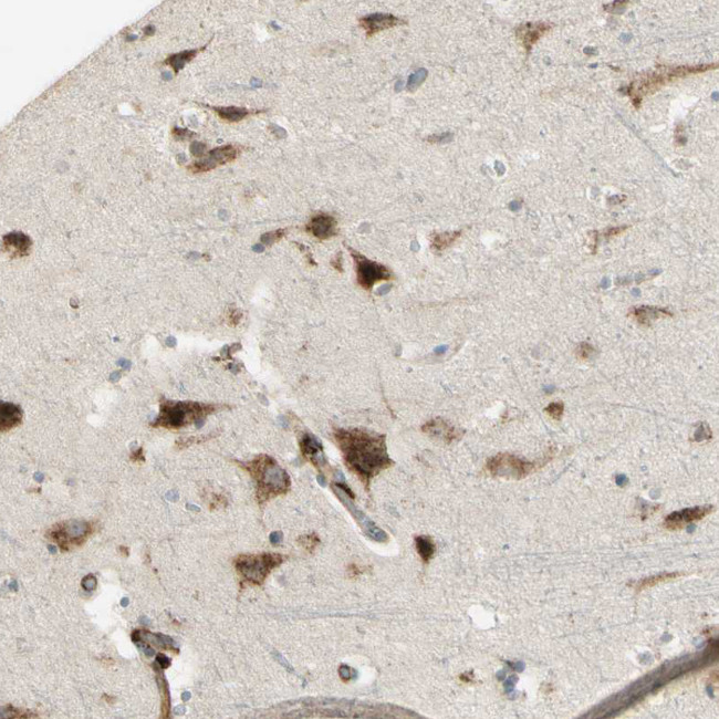 NDFIP1 Antibody in Immunohistochemistry (IHC)