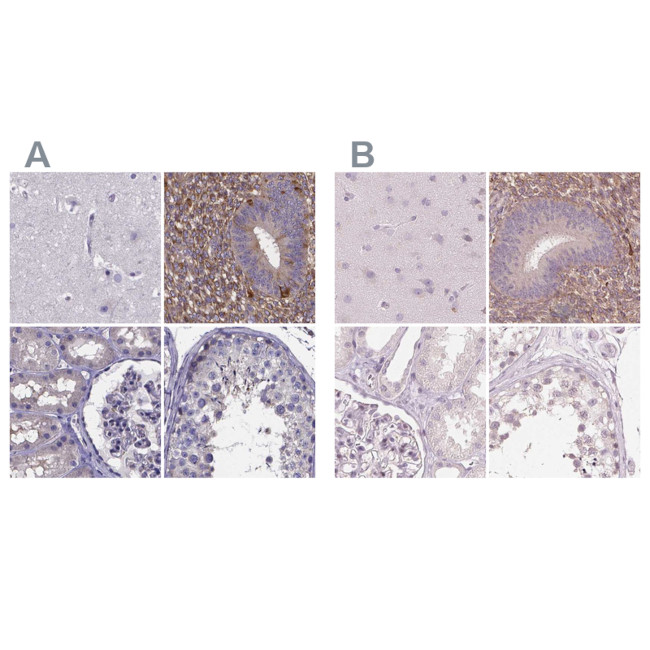 SFRP4 Antibody in Immunohistochemistry (IHC)