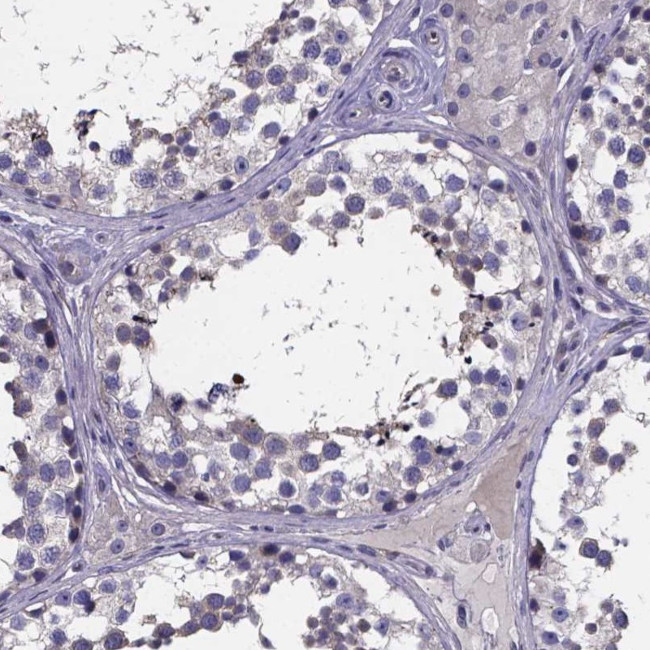 SFRP4 Antibody in Immunohistochemistry (IHC)