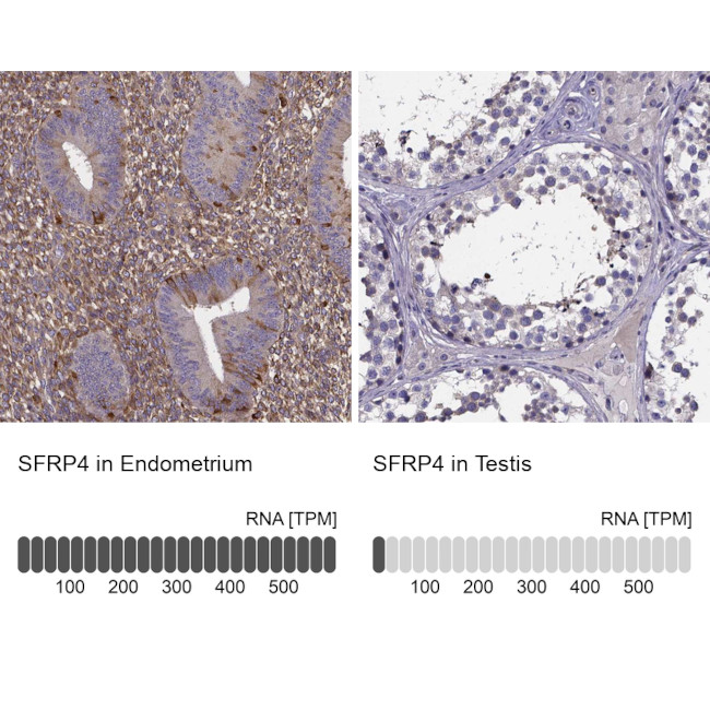 SFRP4 Antibody