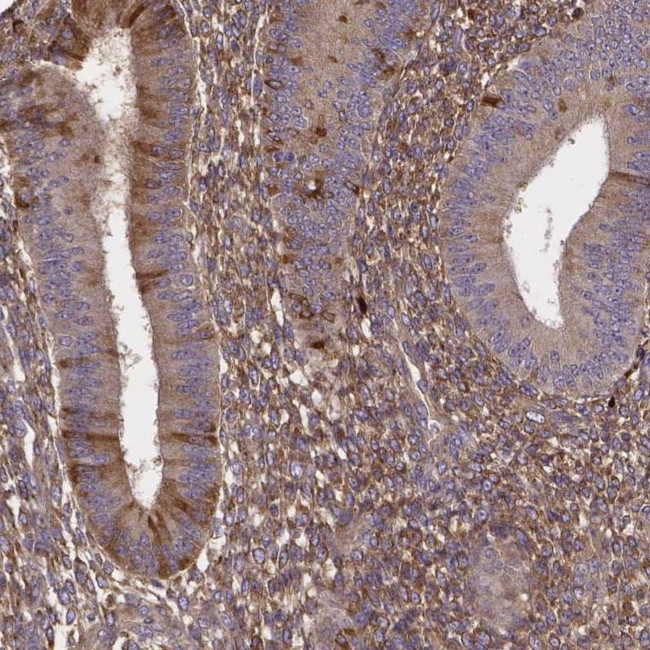 SFRP4 Antibody in Immunohistochemistry (IHC)