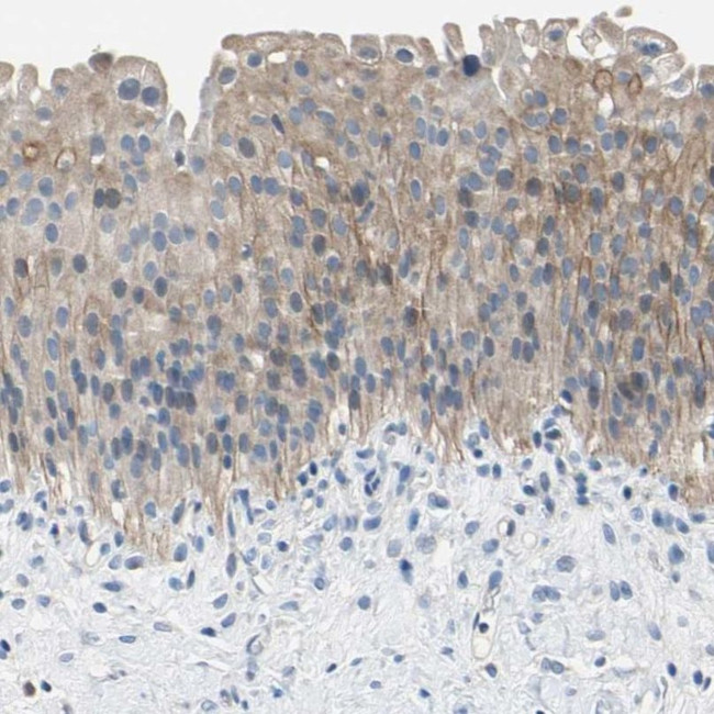 PNKD Antibody in Immunohistochemistry (IHC)