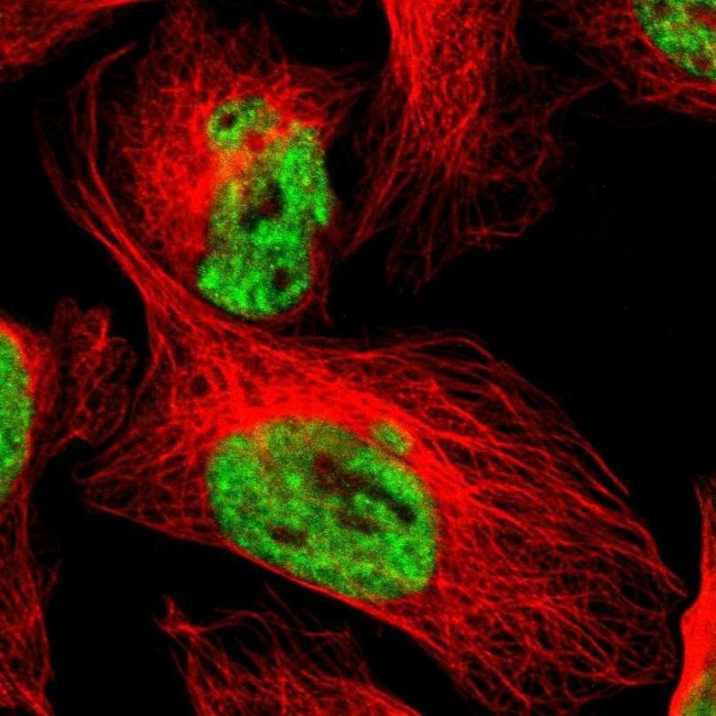 WTAP Antibody in Immunocytochemistry (ICC/IF)