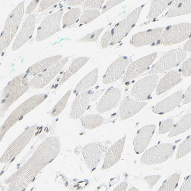 WTAP Antibody in Immunohistochemistry (IHC)