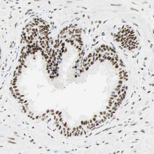 WTAP Antibody in Immunohistochemistry (IHC)