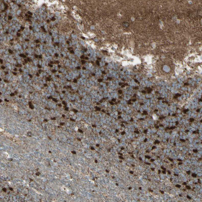 RHOT1 Antibody in Immunohistochemistry (IHC)