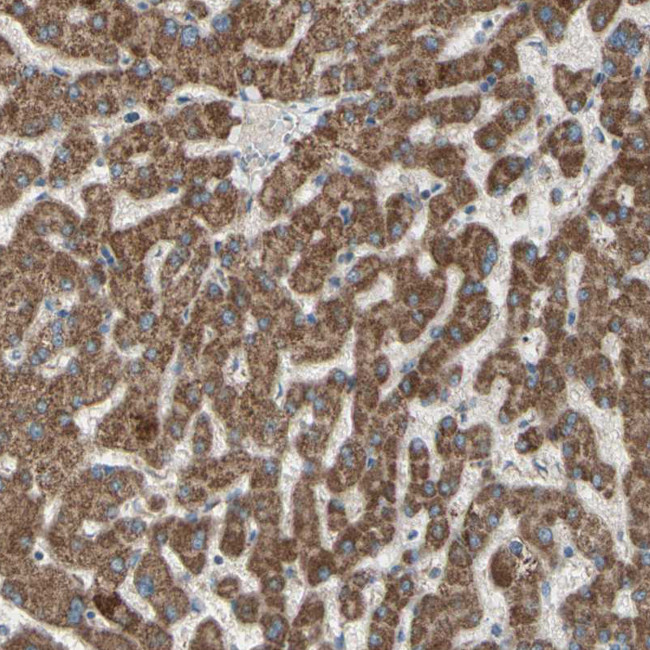 RHOT1 Antibody in Immunohistochemistry (IHC)