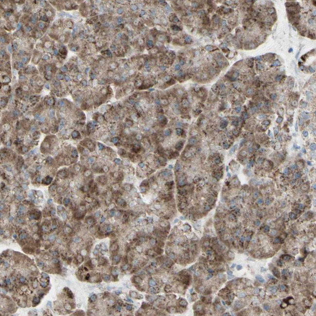 RHOT1 Antibody in Immunohistochemistry (IHC)