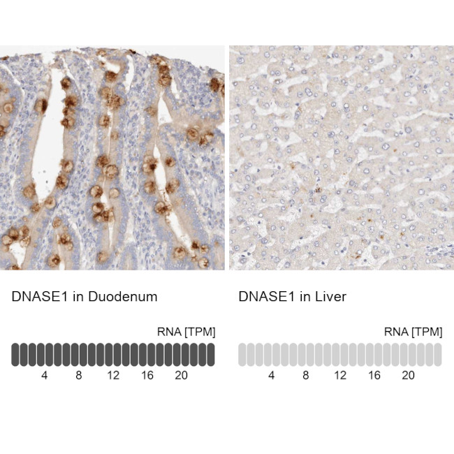 DNASE1 Antibody in Immunohistochemistry (IHC)