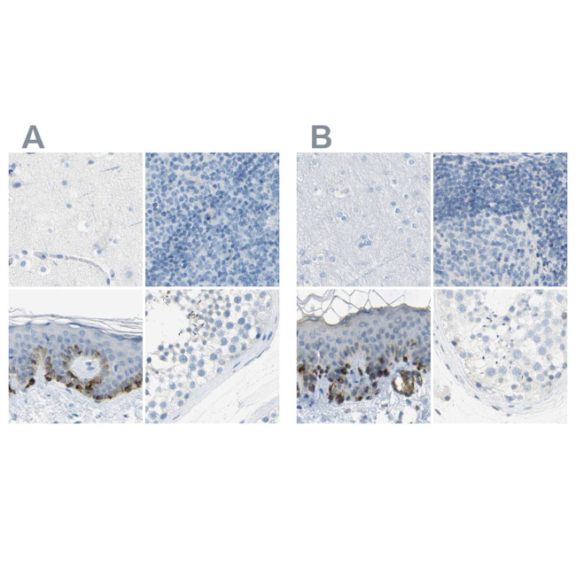 DCT Antibody in Immunohistochemistry (IHC)