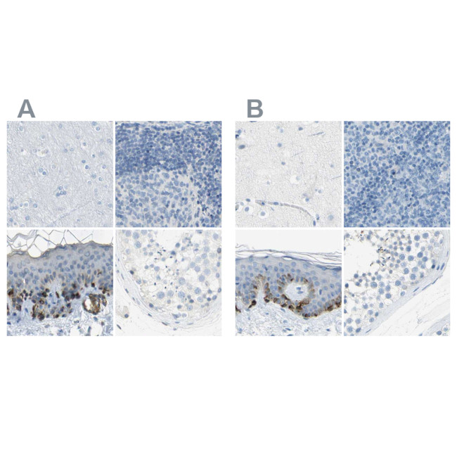 DCT Antibody in Immunohistochemistry (IHC)