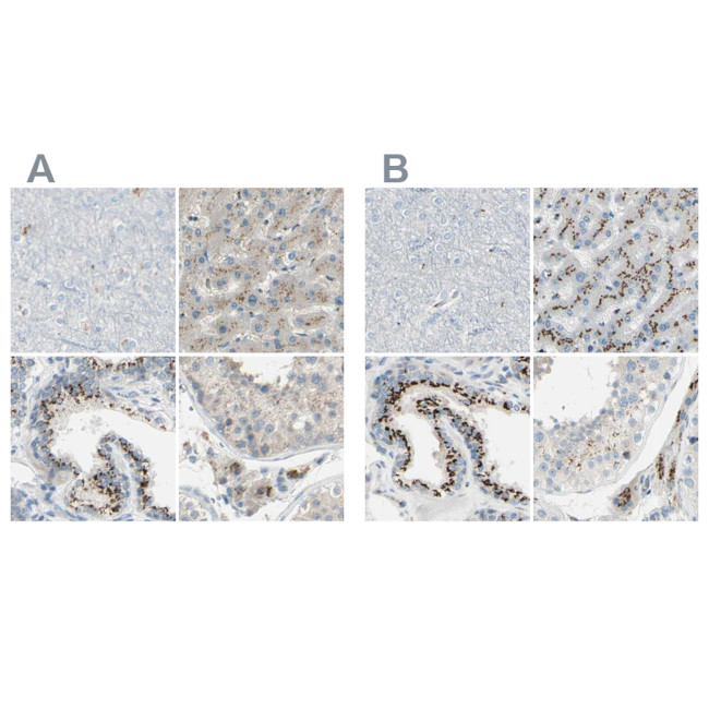 B4GALT1 Antibody in Immunohistochemistry (IHC)