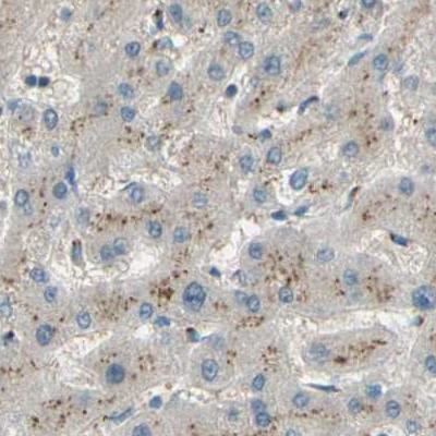 B4GALT1 Antibody in Immunohistochemistry (IHC)