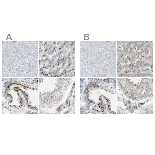 B4GALT1 Antibody in Immunohistochemistry (IHC)