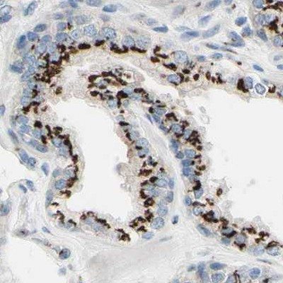 B4GALT1 Antibody in Immunohistochemistry (IHC)