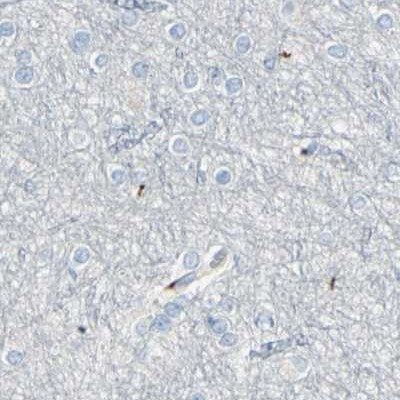 B4GALT1 Antibody in Immunohistochemistry (IHC)