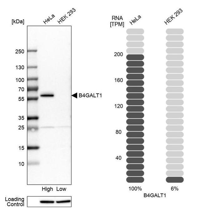 B4GALT1 Antibody in Western Blot (WB)