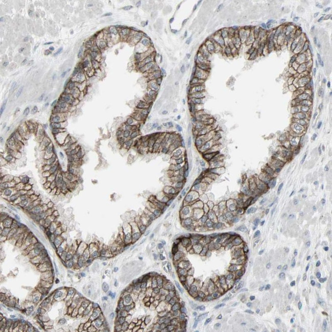 FXYD3 Antibody in Immunohistochemistry (IHC)