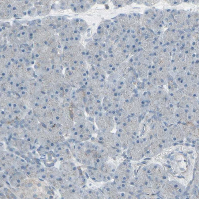 FXYD3 Antibody in Immunohistochemistry (IHC)