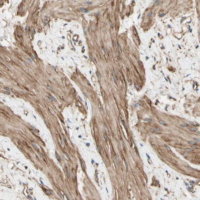 DPYSL3 Antibody in Immunohistochemistry (IHC)